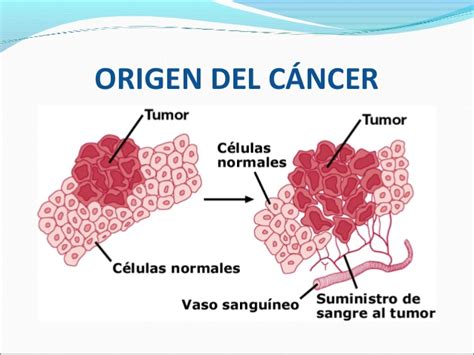 Pacerizu origen del cancer