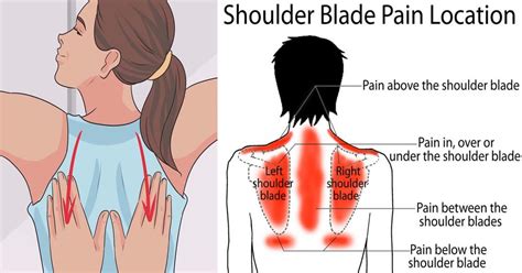 Pain Between Shoulder Blades = Cancer??