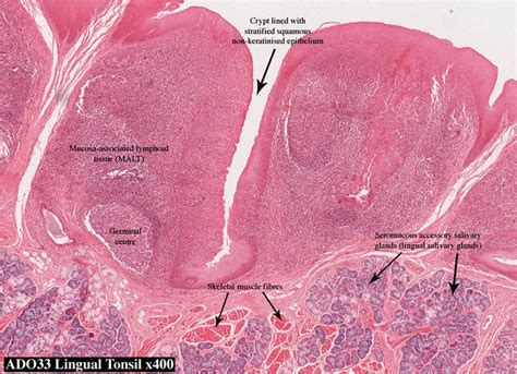 palatine tonsil histology   Google Search | Anatomy and ...