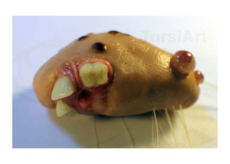 Parasitic Twin Gaff Foetus in fetu oddity with Hair and Teeth