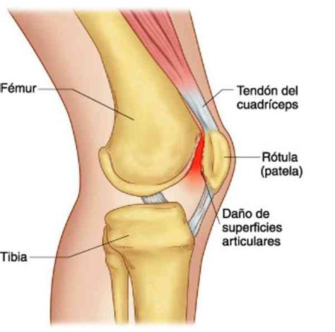 Partes de la rodilla
