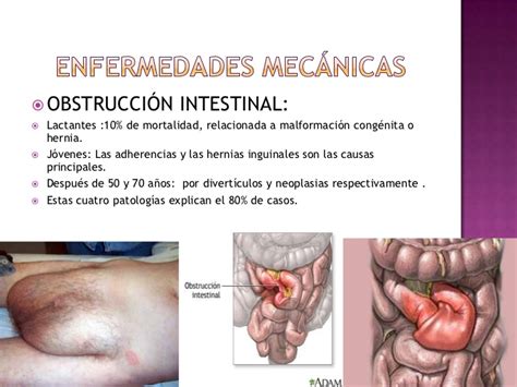 Patologías del intestino delgado 2012