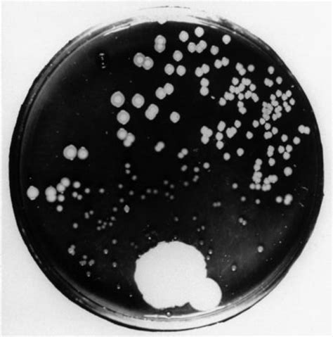 Penicilina   Antibiótico   InfoEscola