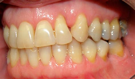 Periodoncia | Tratamientos | Clínica dental Euskalduna