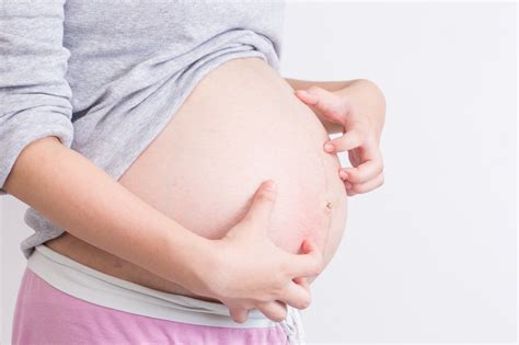 Picor en la barriga de embarazo | Lets Family   Embarazo ...