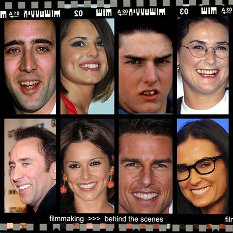¿Por qué los famosos tienen unos dientes perfectos ...