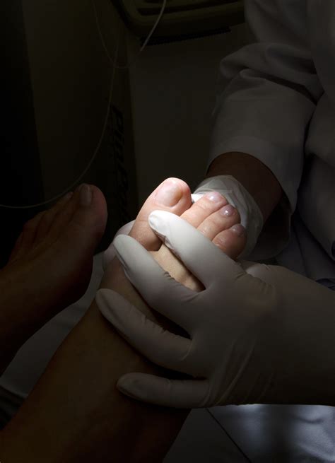 ¿Por qué se hinchan mis pies? | Noticias de Salud en ...