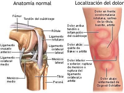 Posibles causas del dolor de rodilla | BuenaForma ...