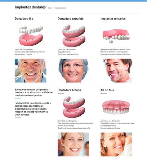 Posicionamiento SEO para clínicas dentales   Gruparts Dental