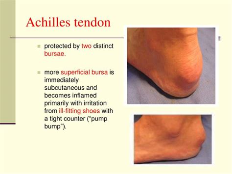 PPT   Foot and Ankle Pain PowerPoint Presentation   ID:5326379