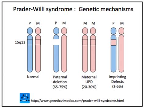 Prader Willi Syndrome | Pediatrics Clerkship | The ...