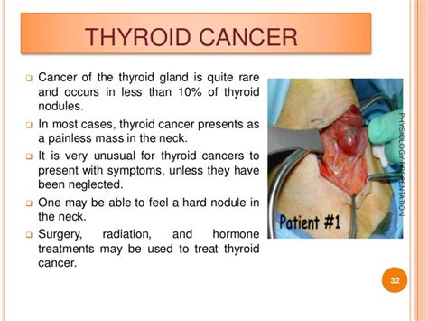 Presentation on Thyroid gland;Its problems,symptoms and ...