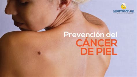 Prevención del cáncer de piel SaludPanama.com