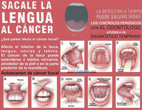 Prevenir el cáncer bucal | Jujuy Al Momento