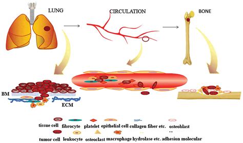 Progress in the research on the mechanism of bone ...