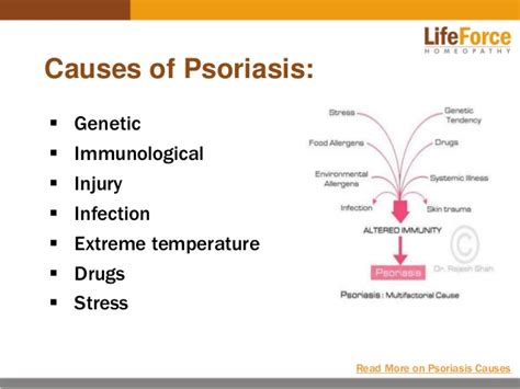 Psoriasis: Causes & Homeopathic Treatment for Psoriasis in ...