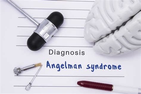 ¿Qué es el síndrome de Angelman?¿Tiene tratamiento ...