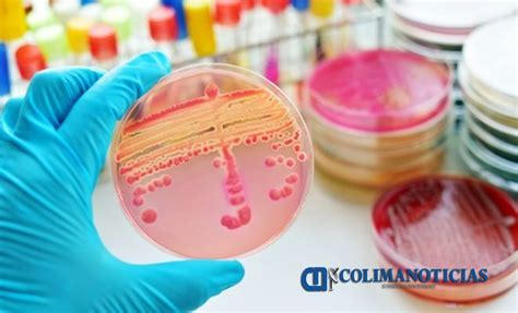 ¿Qué es la difteria y cómo se contagia? | Colima Noticias