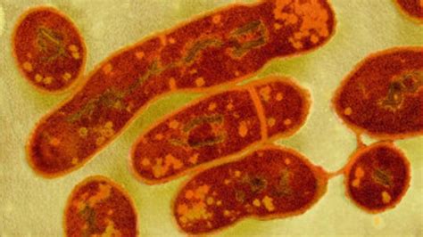 ¿Qué es la difteria y cómo se contagia?