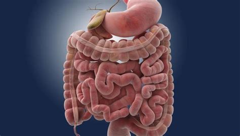 ¿Qué es una obstrucción intestinal? Causas, Síntomas y ...