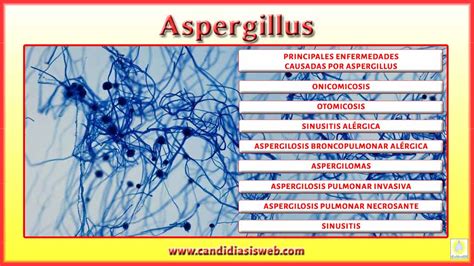¿Qué es?   Aspergillus