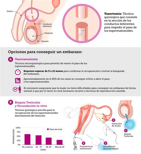 Que Se Hacen Los Espermatozoides Despues De La Vasectomia ...