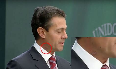 ¿Qué tiene en el cuello Peña Nieto? – Noticias de Morelos ...
