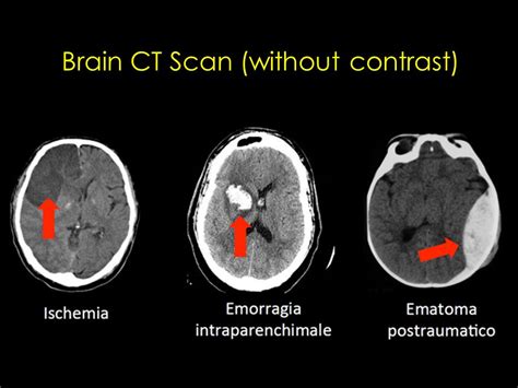 Radiology Course CT scan   ppt video online download
