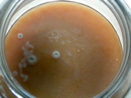 Raw Kombucha Yeast Infection Guide
