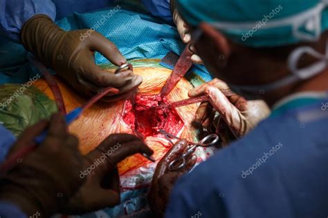 Real hip replacement surgery in progress — Stock Photo ...