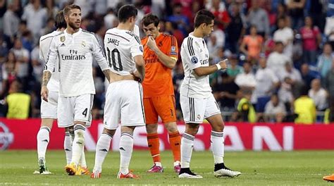 Real Madrid: Donde más duele   MARCA.com
