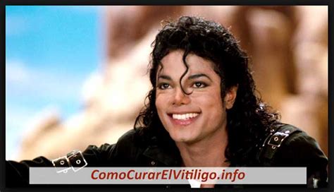¿Realmente Michael Jackson tenía Vitiligo?