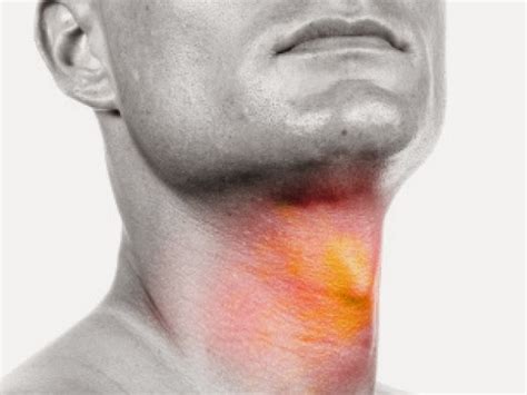 Recognize the Symptoms of Throat Cancer | Diseases and Viruses