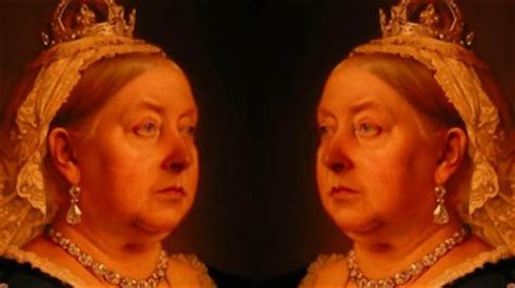 Reina Victoria de Inglaterra pasó el gen de la hemofilia a ...