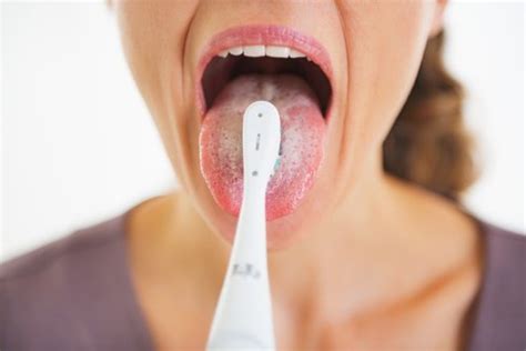 Remedios para hongos en la lengua | Remedios 10