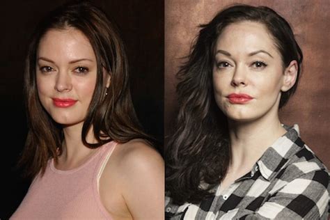 Rose McGowan Plastic Surgery Before And After Photos