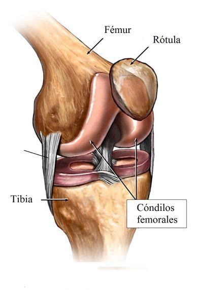 Rotura del ligamento colateral interno, rodilla, esguince