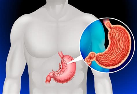 Ruidos en el estómago y qué pueden decirnos sobre la salud