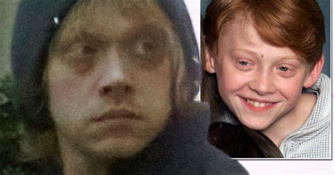 Rupert Grint s shocking transformation and the changing ...