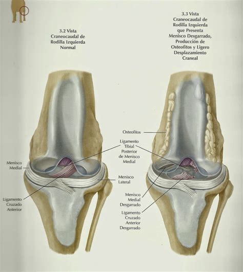 Ruptura del ligamento cruzado craneal de la rodilla