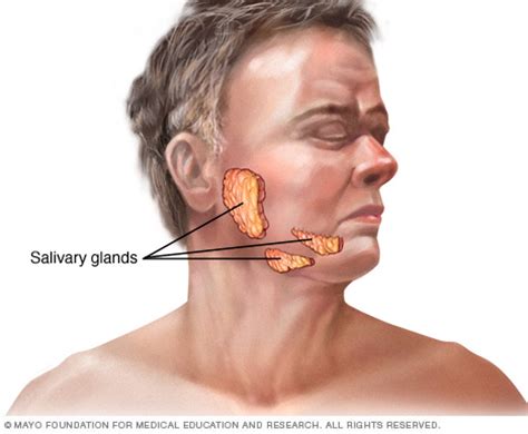 Salivary gland cancer Disease Reference Guide   Drugs.com