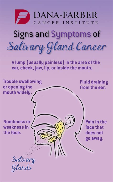 Salivary Gland Cancer: What are the Symptoms? | Dana Farber