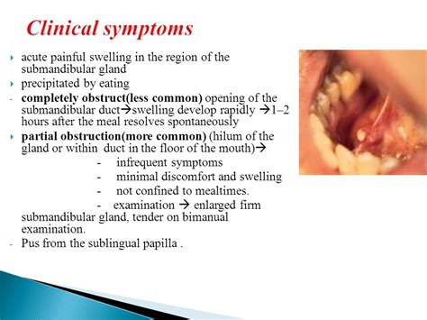 Salivary Glands Dr. ZAID MUWAFAQ AL HAMID   ppt video ...