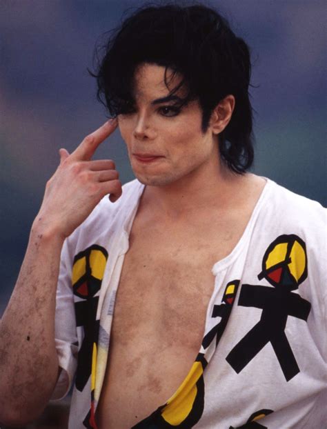 Scienceclaims that they don’t know what causes Vitiligo ...