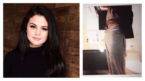 Selena Gomez: ¿tiene cura la enfermedad que padece la ...