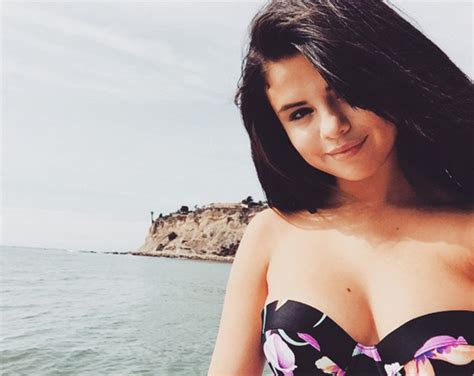 Selena Gomez’s Diagnosis: What Is Lupus? — 5 Things To ...