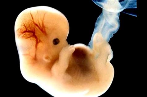 Semana 8 de embarazo: ¡el embrión empieza a tener forma ...