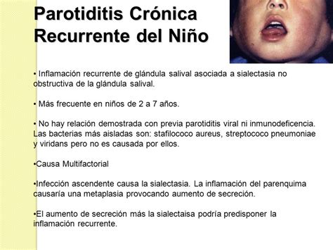 Seminario Odontopediatría. Parotiditis   ppt video online ...