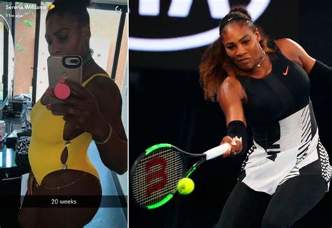 Serena Williams confirmó que está embarazada | 442