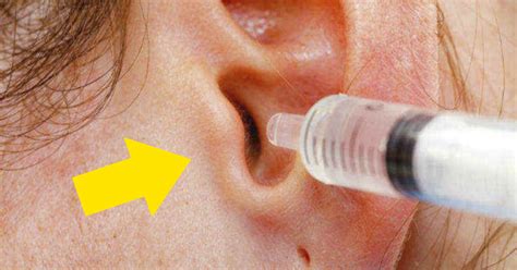 Si tienes problemas de cera o infecciones en los oídos ...